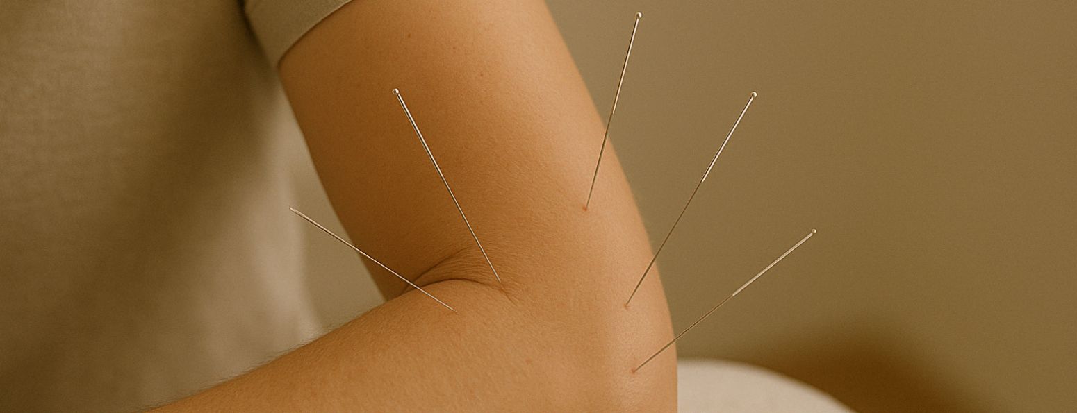 Tennis Elbow treatment in solana beach